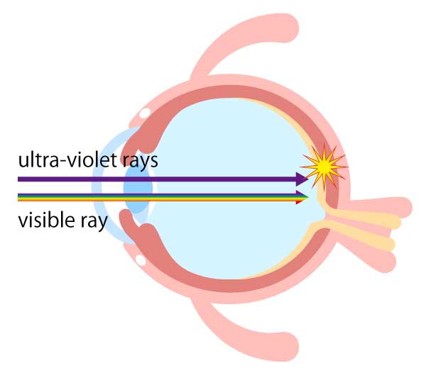 Illustration of ultraviolet rays entering through the eyes